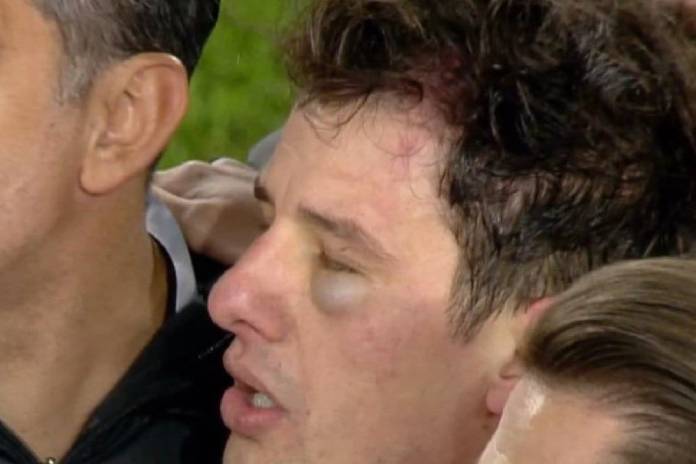 তুর্কি সুপার লিগ